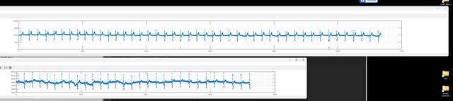 Heartly development photograph &mdash; Heartly_2Leads.png